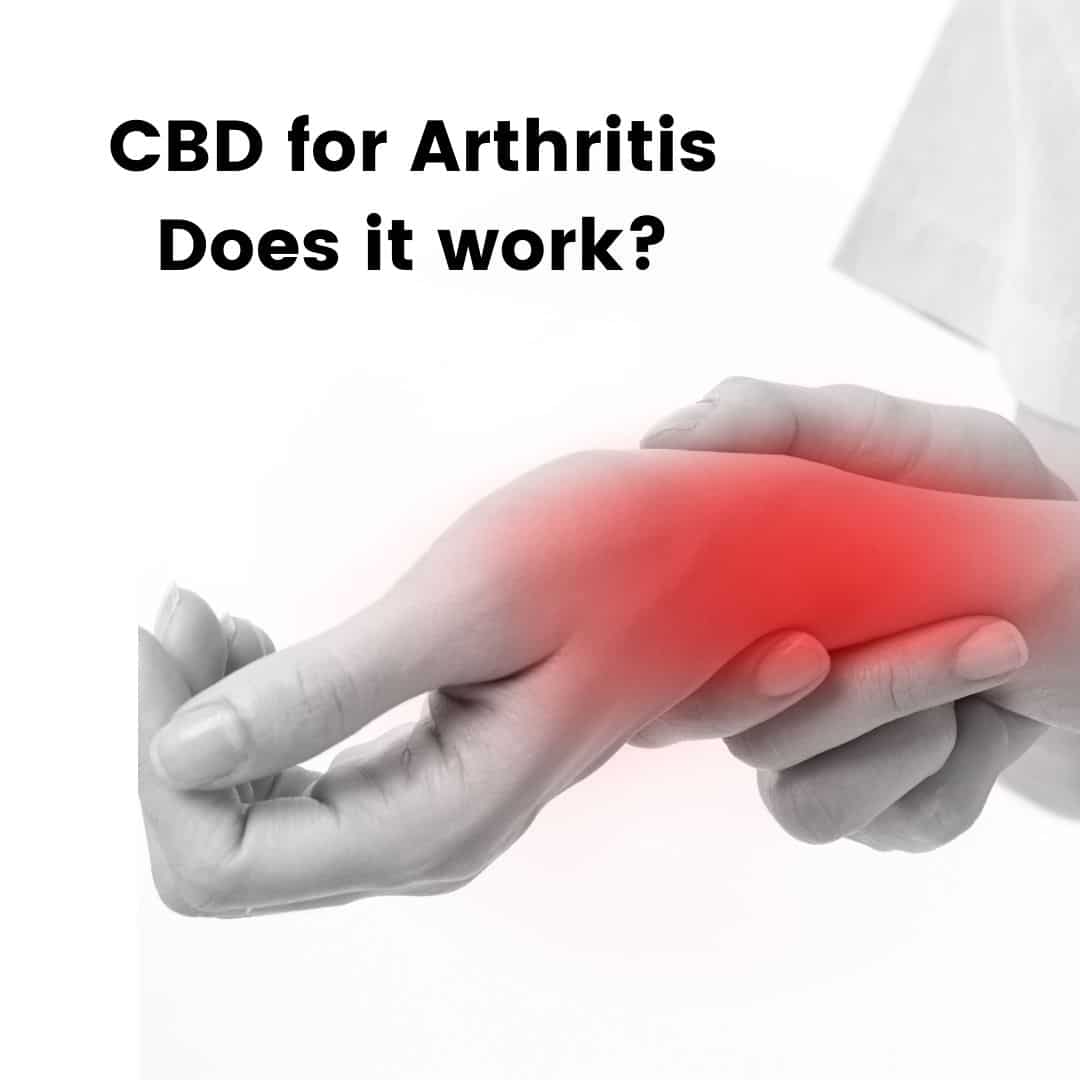CBD for Arthritis: Does it Work?