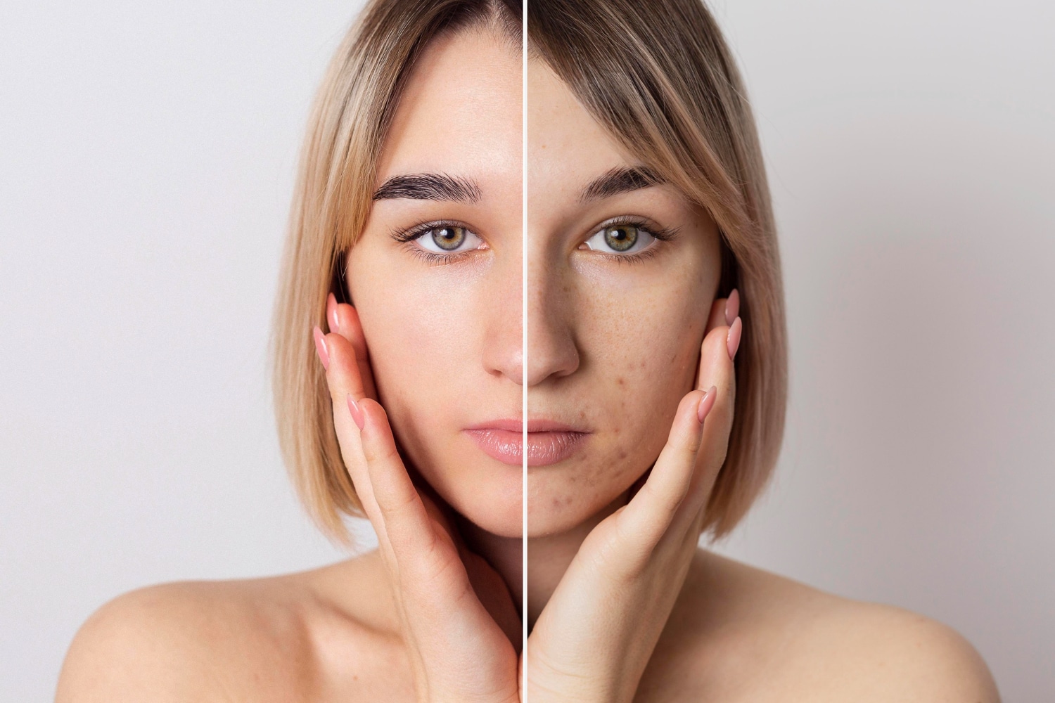 Clear Skin, Clear Mind The Ultimate Guide to CBD for Acne and Wrinkles