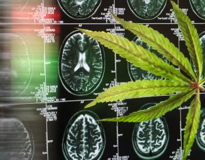 Treating Dementia With Cannabis